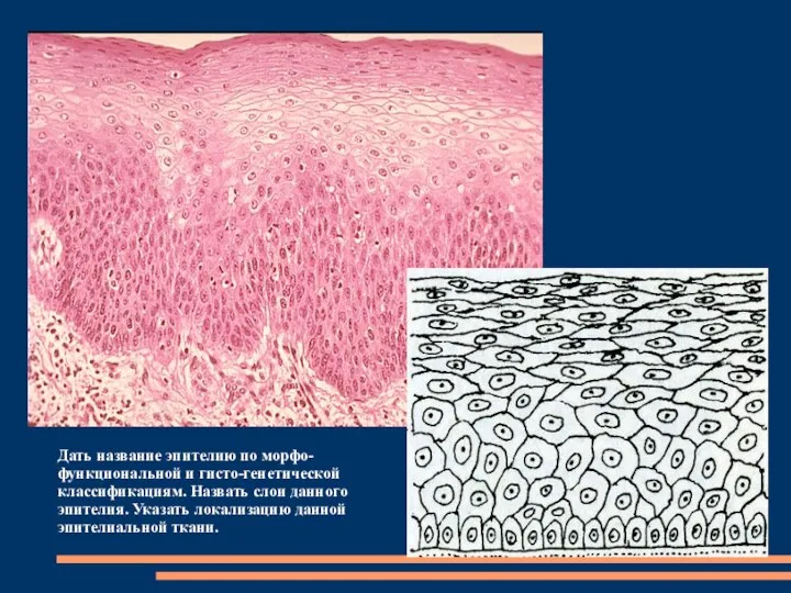 Дать название эпителию по морфо-функциональной и гисто-генетической классификациям. Назвать слои данного