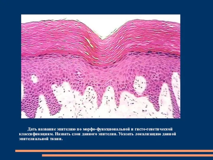 Дать название эпителию по морфо-функциональной и гисто-генетической классификациям. Назвать слои данного