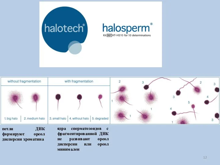 ядра сперматозоидов с фрагментированной ДНК не развивают ореол дисперсии или ореол