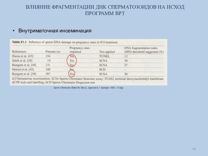 ВЛИЯНИЕ ФРАГМЕНТАЦИИ ДНК СПЕРМАТОЗОИДОВ НА ИСХОД ПРОГРАММ ВРТ Внутриматочная инсеминация Sperm