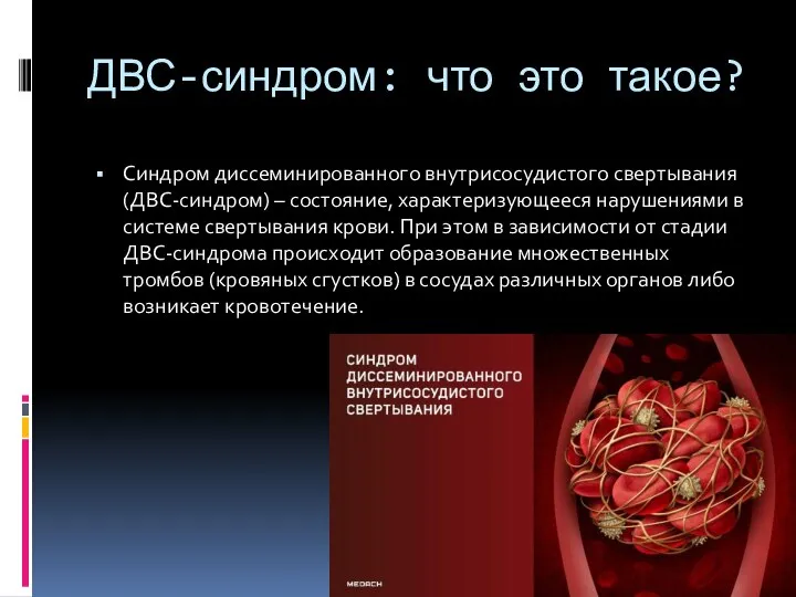 ДВС-синдром: что это такое? Синдром диссеминированного внутрисосудистого свертывания (ДВС-синдром) – состояние,