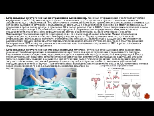 Добровольная хирургическая контрацепция для женщин. Женская стерилизация представляет собой хирургическое блокирование