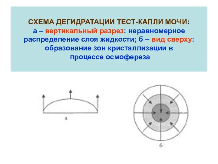 СХЕМА ДЕГИДРАТАЦИИ ТЕСТ-КАПЛИ МОЧИ: а – вертикальный разрез: неравномерное распределение слоя