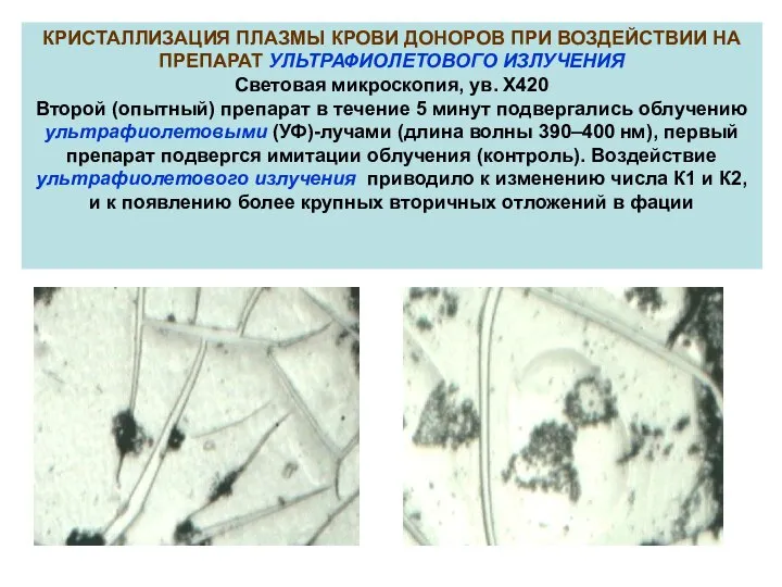 КРИСТАЛЛИЗАЦИЯ ПЛАЗМЫ КРОВИ ДОНОРОВ ПРИ ВОЗДЕЙСТВИИ НА ПРЕПАРАТ УЛЬТРАФИОЛЕТОВОГО ИЗЛУЧЕНИЯ Световая