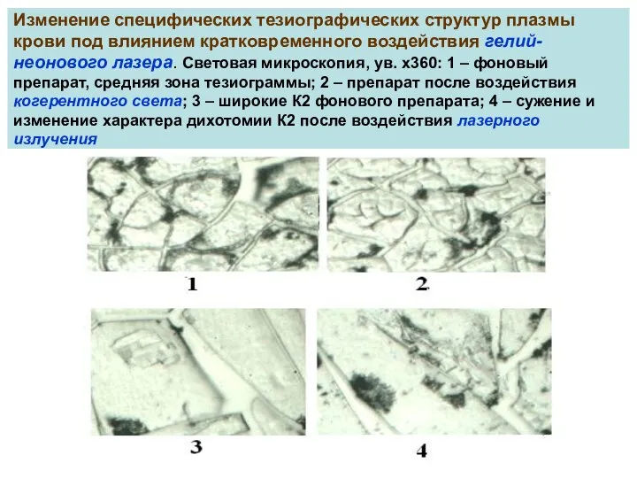 Изменение специфических тезиографических структур плазмы крови под влиянием кратковременного воздействия гелий-неонового