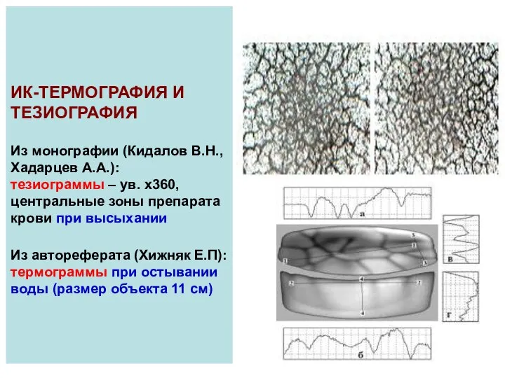 ИК-ТЕРМОГРАФИЯ И ТЕЗИОГРАФИЯ Из монографии (Кидалов В.Н., Хадарцев А.А.): тезиограммы –