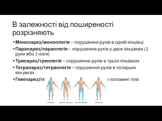 В залежності від поширеності розрізняють Монопарез/моноплегія – порушення рухів в одній