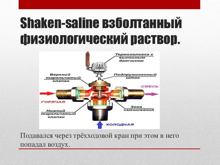 Shaken-saline взболтанный физиологический раствор. Подавался через трёхходовой кран при этом в него попадал воздух.