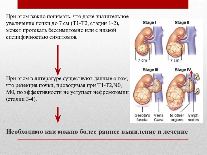 Необходимо как можно более раннее выявление и лечение При этом важно