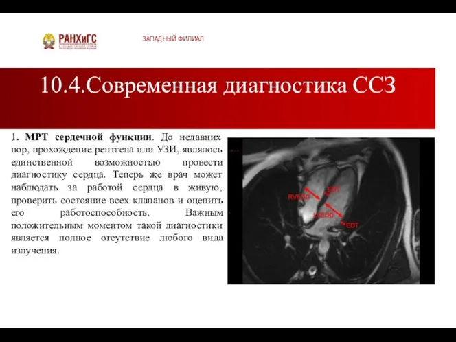 10.4.Современная диагностика ССЗ ЗАПАДНЫЙ ФИЛИАЛ . 1. МРТ сердечной функции. До