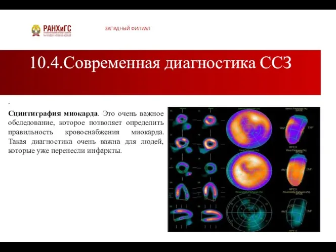 10.4.Современная диагностика ССЗ ЗАПАДНЫЙ ФИЛИАЛ . Сцинтиграфия миокарда. Это очень важное