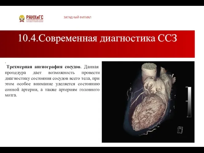 10.4.Современная диагностика ССЗ ЗАПАДНЫЙ ФИЛИАЛ . Трехмерная ангиография сосудов. Данная процедура