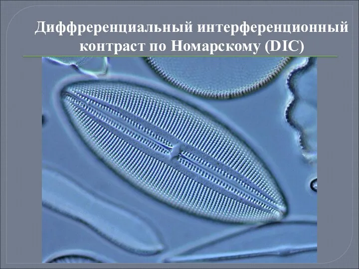 Диффреренциальный интерференционный контраст по Номарскому (DIC)