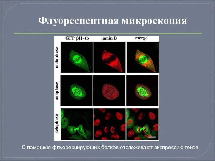 С помощью флуоресцирующих белков отслеживают экспрессию генов Флуоресцентная микроскопия