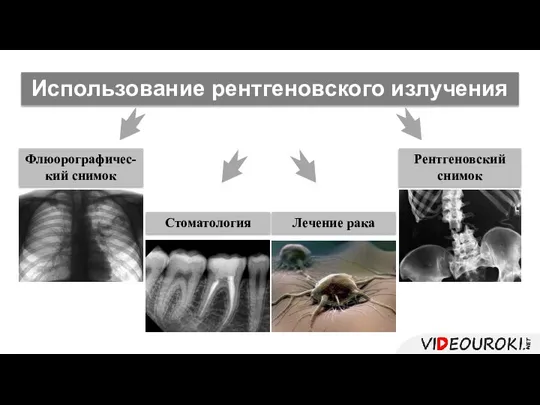 Использование рентгеновского излучения Флюорографичес- кий снимок Стоматология Рентгеновский снимок Лечение рака