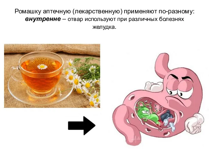 Ромашку аптечную (лекарственную) применяют по-разному: внутренне – отвар используют при различных болезнях желудка.