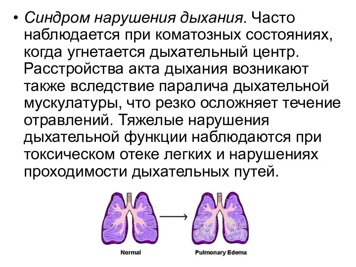 Синдром нарушения дыхания. Часто наблюдается при коматозных состояниях, когда угнетается дыхательный