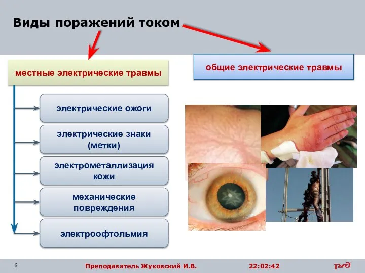 Виды поражений током местные электрические травмы общие электрические травмы электрические ожоги