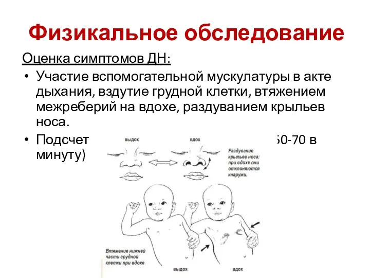 Физикальное обследование Оценка симптомов ДН: Участие вспомогательной мускулатуры в акте дыхания,