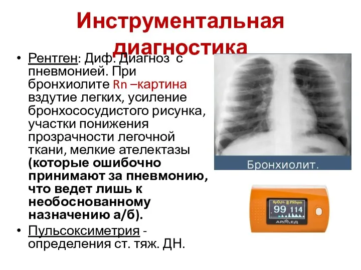 Инструментальная диагностика Рентген: Диф. Диагноз с пневмонией. При бронхиолите Rn –картина