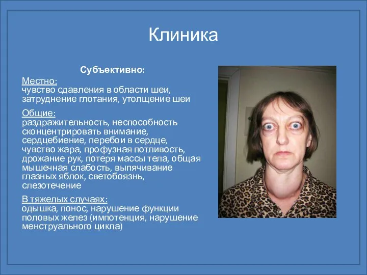 Клиника Субъективно: Местно: чувство сдавления в области шеи, затруднение глотания, утолщение