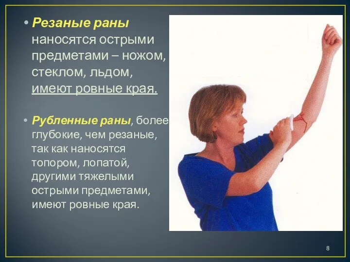 Резаные раны наносятся острыми предметами – ножом, стеклом, льдом, имеют ровные