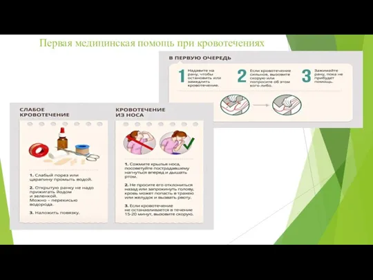 Первая медицинская помощь при кровотечениях