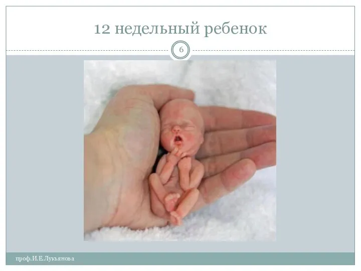 12 недельный ребенок проф.И.Е.Лукьянова