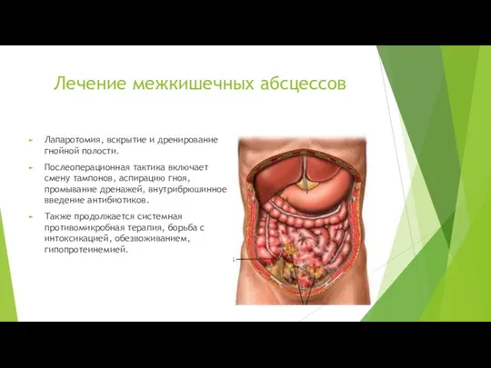 Лечение межкишечных абсцессов Лапаротомия, вскрытие и дренирование гнойной полости. Послеоперационная тактика