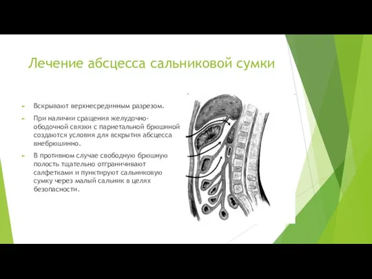 Лечение абсцесса сальниковой сумки Вскрывают верхнесрединным разрезом. При наличии сращения желудочно-ободочной