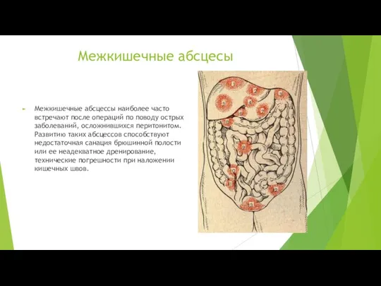 Межкишечные абсцесы Межкишечные абсцессы наиболее часто встречают после операций по поводу