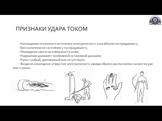 ПРИЗНАКИ УДАРА ТОКОМ - Нахождение оголенного источника электрического тока вблизи пострадавшего;