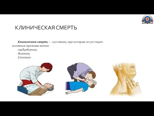 КЛИНИЧЕСКАЯ СМЕРТЬ Клиническая смерть – состояние, при котором отсутствуют основные признаки жизни: сердцебиение; дыхание; Сознание.