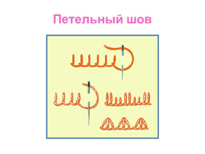 Петельный шов