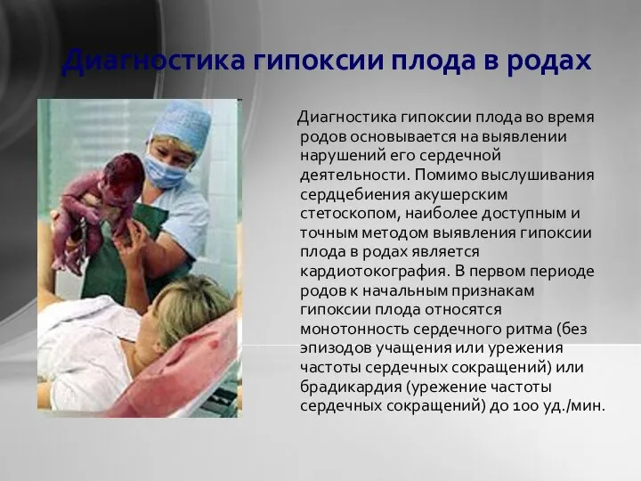 Диагностика гипоксии плода в родах Диагностика гипоксии плода во время родов