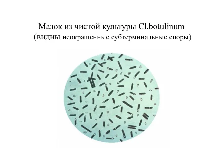 Мазок из чистой культуры Cl.botulinum (видны неокрашенные субтерминальные споры)