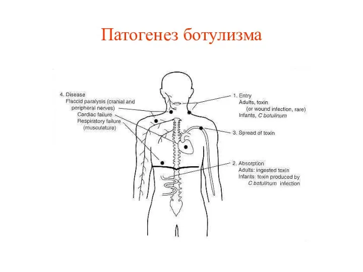 Патогенез ботулизма