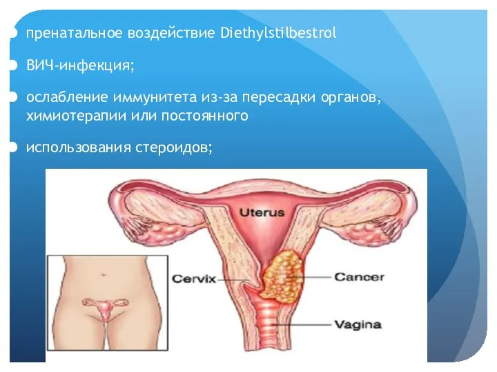 пренатальное воздействие Diethylstilbestrol ВИЧ-инфекция; ослабление иммунитета из-за пересадки органов, химиотерапии или постоянного использования стероидов;