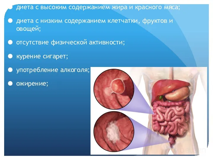 диета с высоким содержанием жира и красного мяса; диета с низким