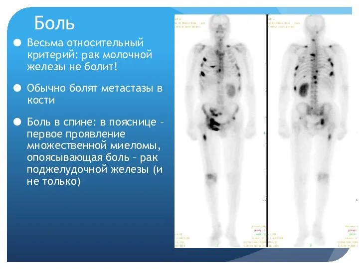 Боль Весьма относительный критерий: рак молочной железы не болит! Обычно болят