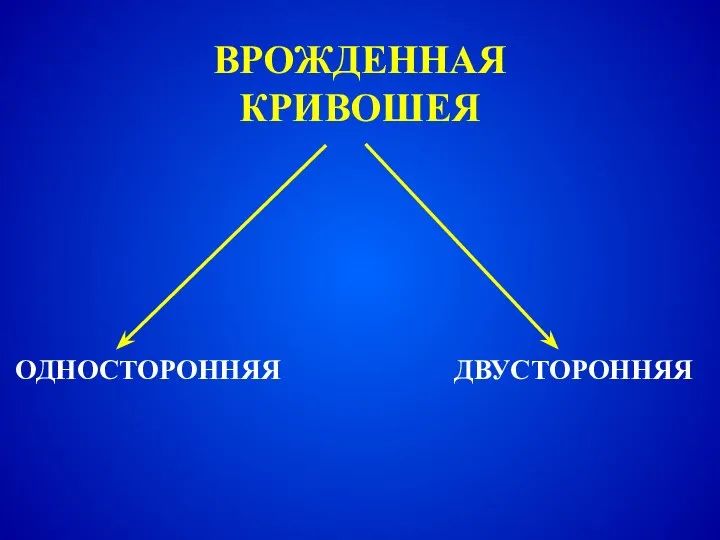 ВРОЖДЕННАЯ КРИВОШЕЯ