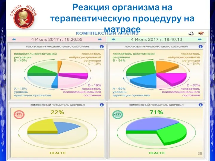 Реакция организма на терапевтическую процедуру на матрасе