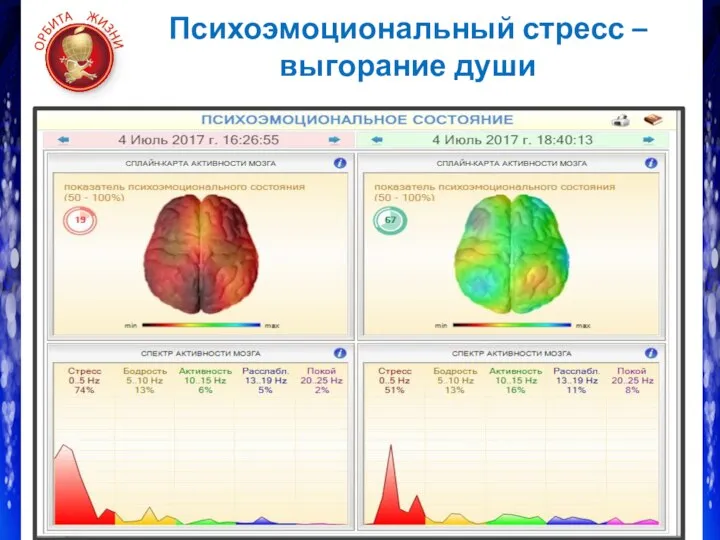 Психоэмоциональный стресс – выгорание души