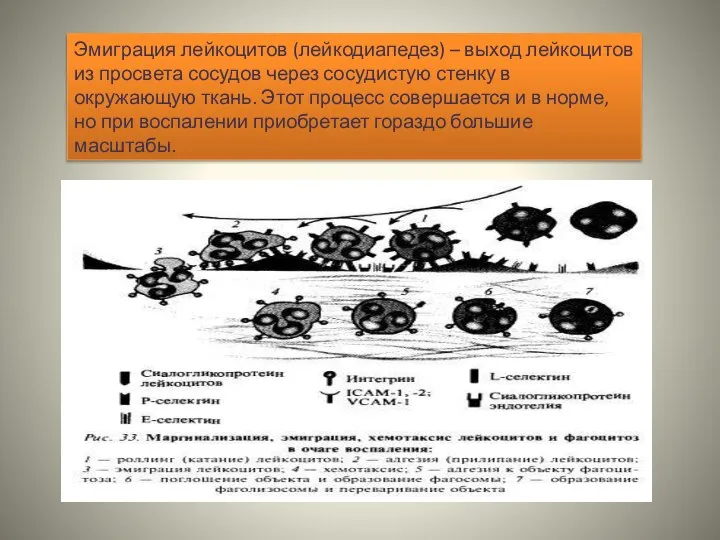 Эмиграция лейкоцитов (лейкодиапедез) – выход лейкоцитов из просвета сосудов через сосудистую