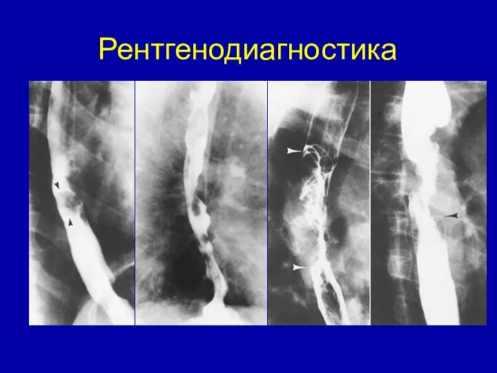 Рентгенодиагностика