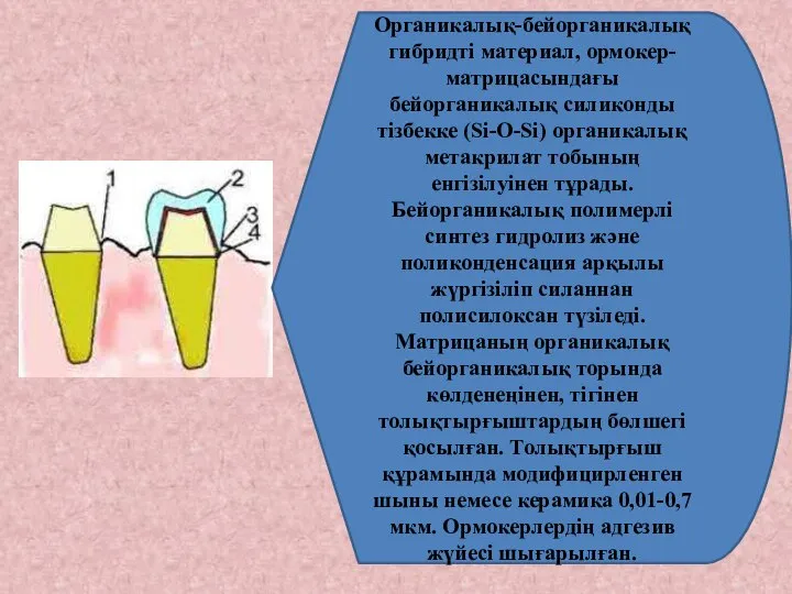 Органикалық-бейорганикалық гибридті материал, ормокер-матрицасындағы бейорганикалық силиконды тізбекке (Si-O-Si) органикалық метакрилат тобының