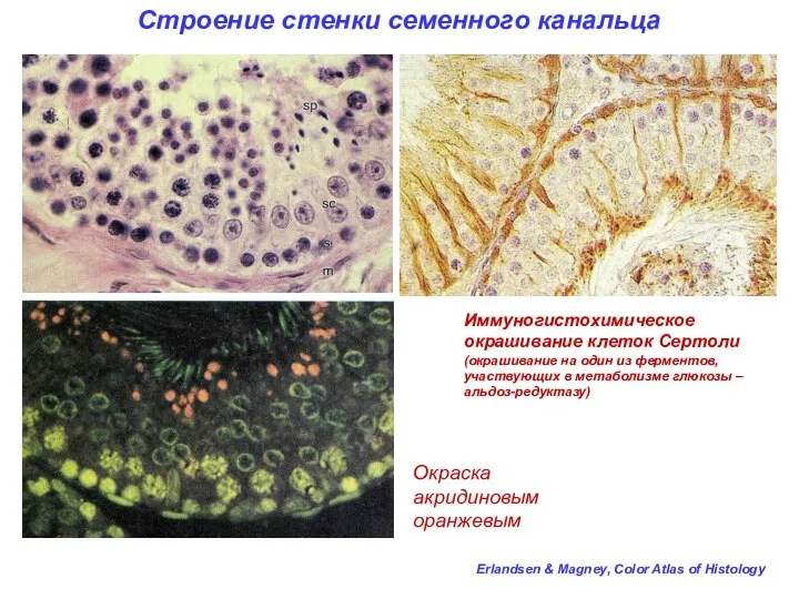 Строение стенки семенного канальца Окраска акридиновым оранжевым Erlandsen & Magney, Color