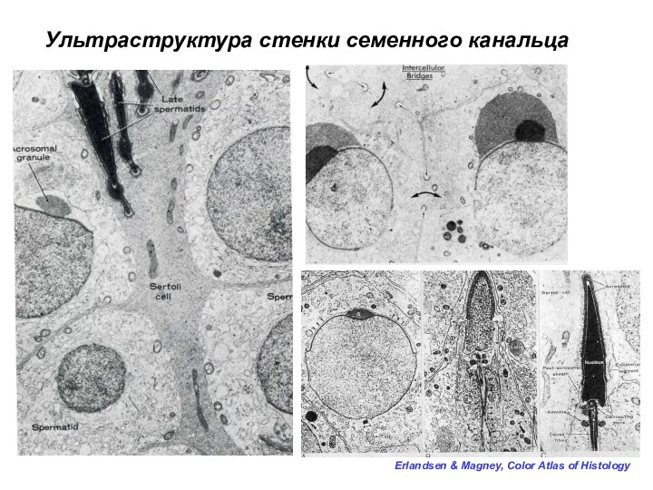 Erlandsen & Magney, Color Atlas of Histology Ультраструктура стенки семенного канальца