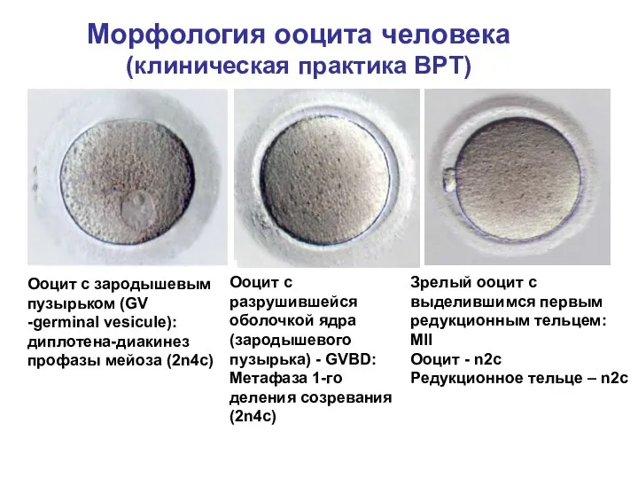 Морфология ооцита человека (клиническая практика ВРТ) Ооцит с зародышевым пузырьком (GV