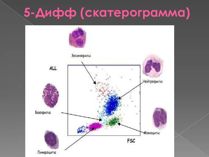 5-Дифф (скатерограмма)